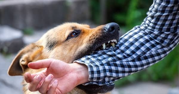 Dog Bite Injury
