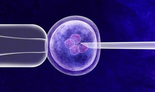 IVF